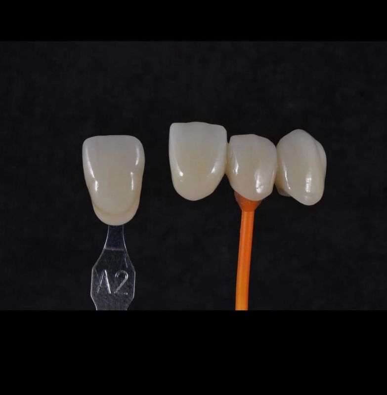 3D Pro Zirconia ฟันสีขาว CAD CAM Block 98/95/92mm ระบบเปิด CE