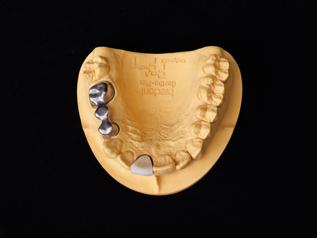 Audental 04 สารสกัดเกียรติ เงิน-พัลลาเดียม สารสกัดโพรเซลีน สีขาว Pd53.3% สําหรับการฟื้นฟูฟันนาน