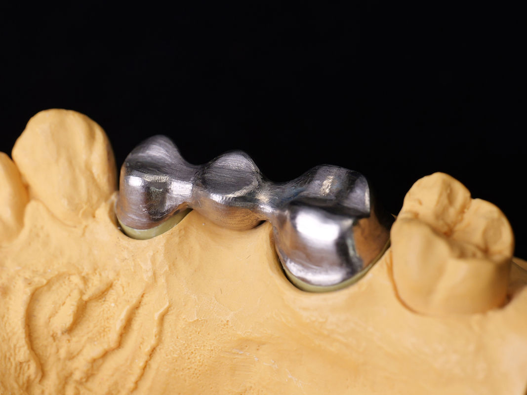 Audental 04 สารสกัดเกียรติ เงิน-พัลลาเดียม สารสกัดโพรเซลีน สีขาว Pd53.3% สําหรับการฟื้นฟูฟันนาน