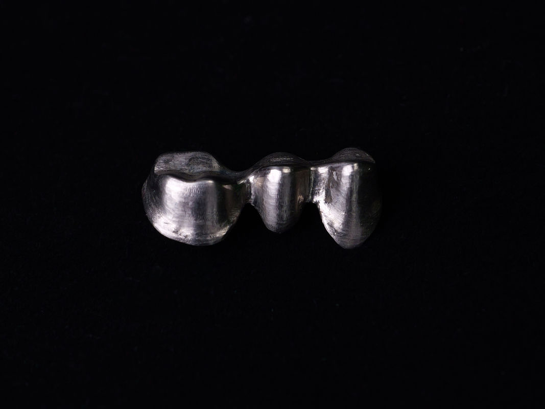 Audental 04 สารสกัดเกียรติ เงิน-พัลลาเดียม สารสกัดโพรเซลีน สีขาว Pd53.3% สําหรับการฟื้นฟูฟันนาน