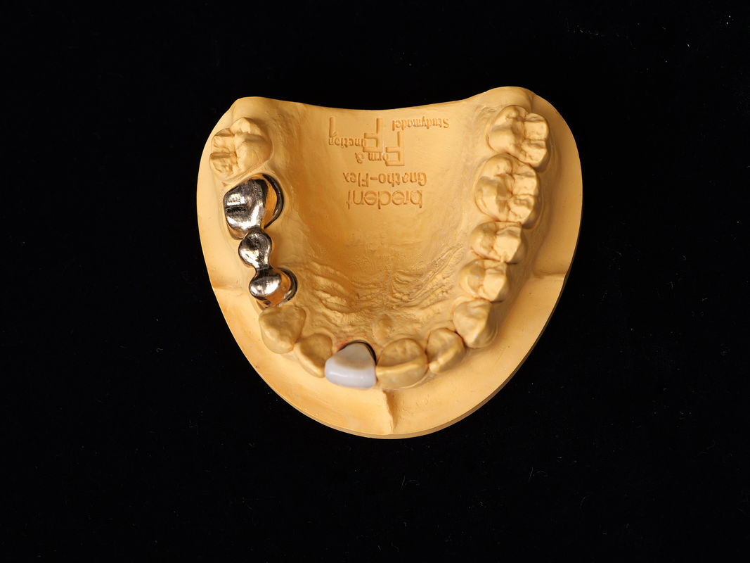 Audental 90 การฟื้นฟูฟัน สังกะสีเกียรติสูง สังกะสีเซรามิกฟัน สีเหลือง Au89.5%
